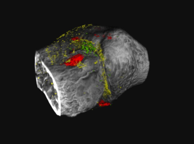 Researchers developed novel contrast agents that target two proteins implicated in osteoarthritis, a degenerative joint disease commonly characterized as wear-and-tear arthritis, and imaged the proteins using a photon-counting CT scanner. Here, the green and red are the targeted nanoparticles, while the yellow is adipose tissue. The white is bone and the gray is cartilage.  Credit: Provided by the Pan Lab. All Rights Reserved.