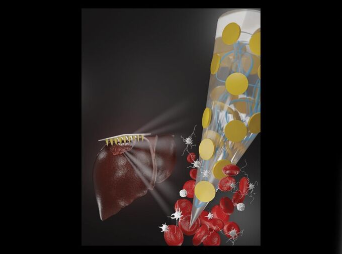 Hemostatic microneedle technology can be applied like a typical adhesive bandage to quickly stop bleeding. The biocompatible and biodegradable microneedle arrays (MNAs) on the patch increase its surface contact with blood to accelerate the clotting process and also increase the adhesive properties of the patch via mechanical interlocking to promote wound closure. Credit: Designed by Amir Sheikhi and Reihaneh Haghniaz/Executed by Natan Barros. All Rights Reserved.