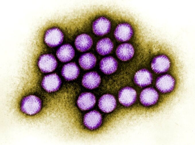 Adenoviruses have emerged as a promising gene-delivery platform for therapeutic and vaccine purposes. But many people have preexisting immunity to human adenoviruses, such as those shown here, which can cause a variety of common illnesses. Using a delivery system based on a modified bovine adenovirus, researchers hope to develop an effective COVID-19 vaccine that avoids issues associated with vector immunity. IMAGE: CDC/DR. G. WILLIAM GARY, JR.