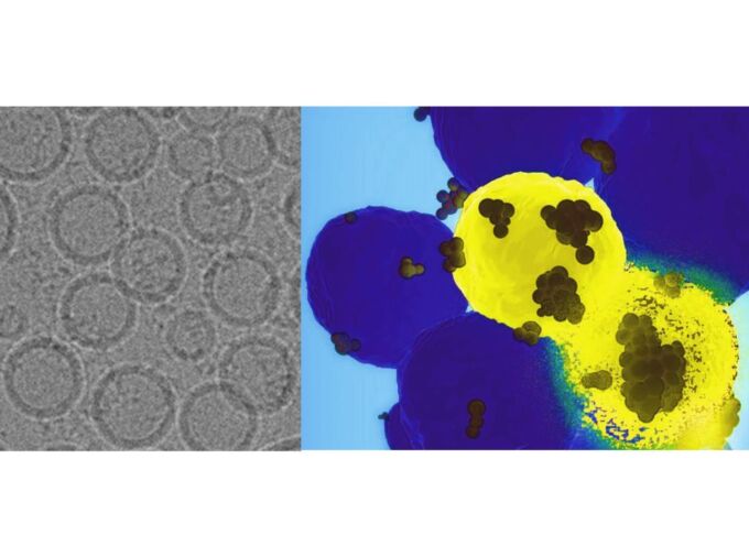 On the left is an electron microscopic image of the nanoparticles designed by the team led by Penn State researchers. On the right, the nanoparticles, shown as black dots, find the basal-like breast cancer cells in yellow and deliver the gene-editing tools. The disintegrating cell demonstrates the destructive power of the therapy delivered by the nanoparticle. Credit: Provided by Dipanjan Pan. All Rights Reserved.