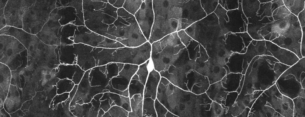 Neurons