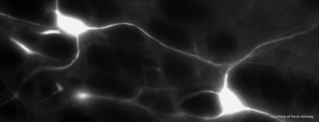 Dopaminergic neurons in the substantia nigra