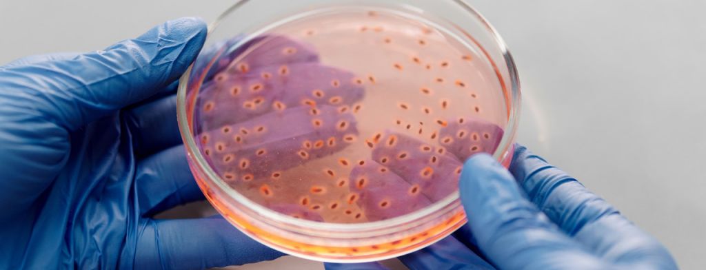 A petri dish containing a translucent orange medium and darker orange dots of microbial growth
