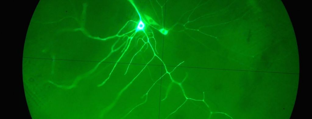 Neuron under a microscope