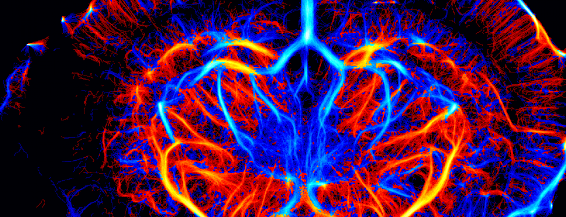 neuroscience hero image of a brain scan
