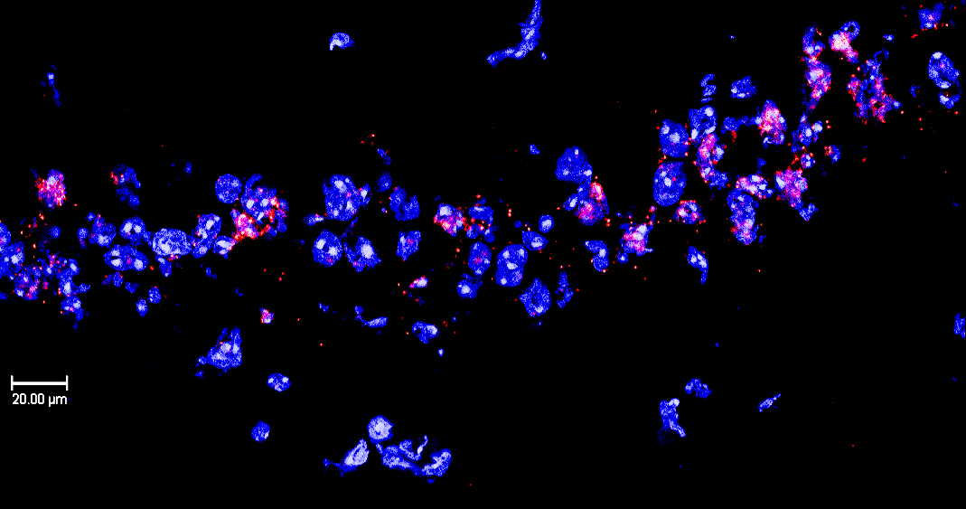 RNA expression of Arc in pink, capturing a marker of the moment of memory formation