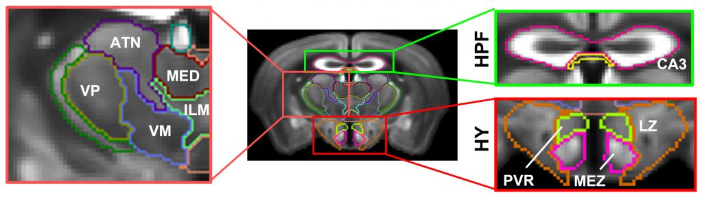 Image of a brain scanned using Manganese-Enhancement MRI
