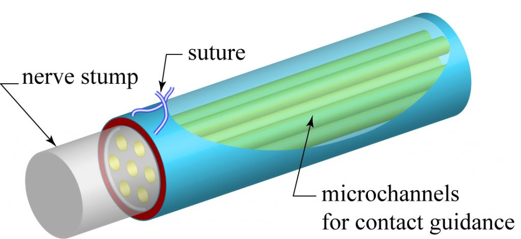 Multi-channeled tissue engineered nerve guide