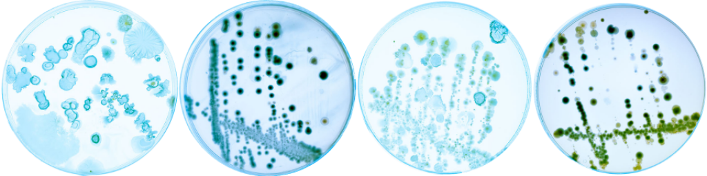 bacteria growing on petri dishes