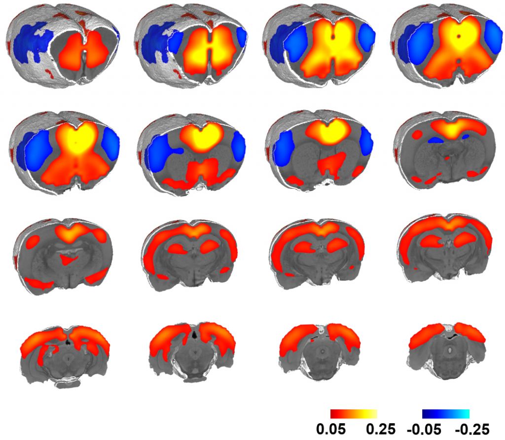 Functional magnetic resonance imaging scans of brains