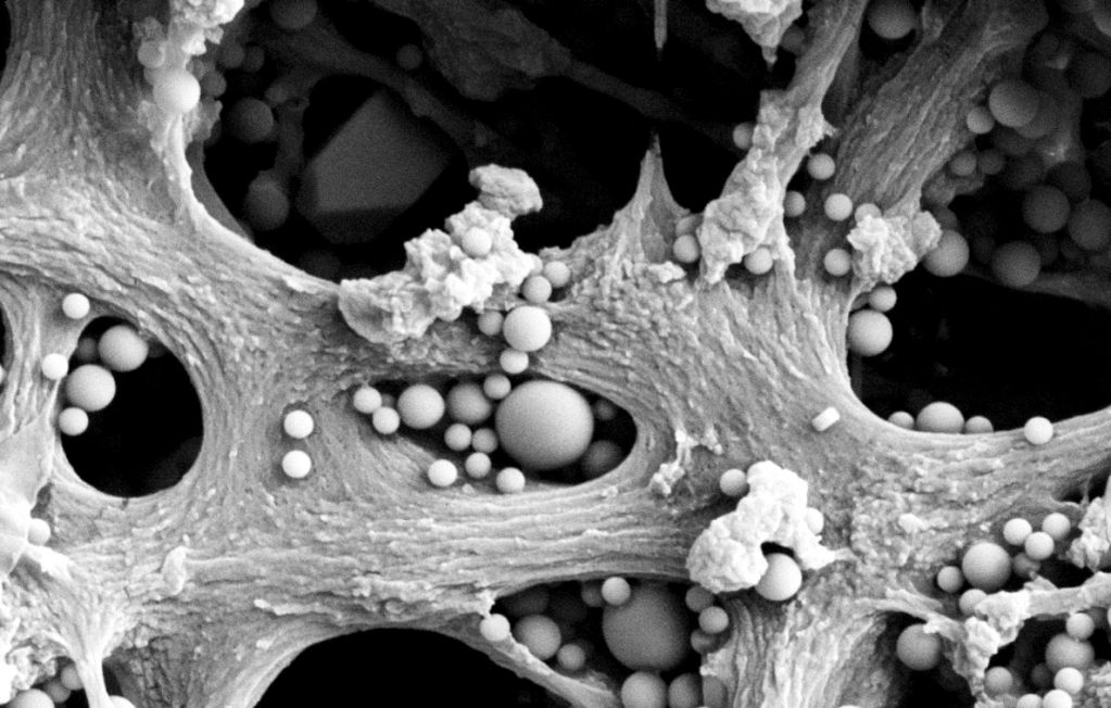 Membranes from a current project under electron microscopy; the small spheres are model particles that are being used to study how and where small particles are captured on and within the pores of the membranes.