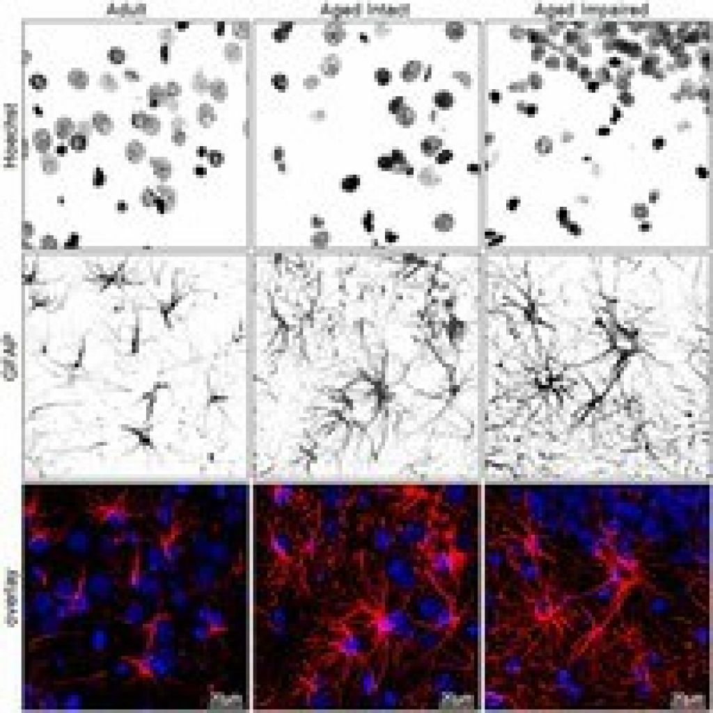 Morphological characteristics of activated astrocytes in aged hippocampus