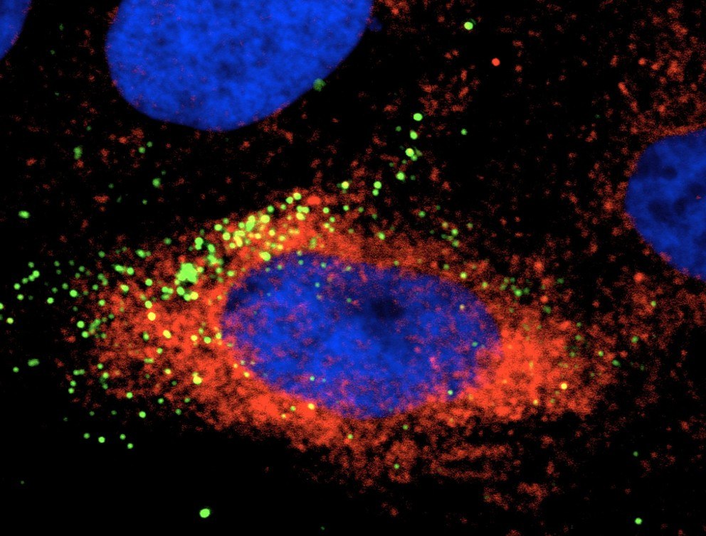 This image shows a cell infected with Zika virus (green). The red is heat shock protein 70 (Hsp70), which appears to play a role in enabling Zika infection of host cells. IMAGE: RASGON LABORATORY / PENN STATE