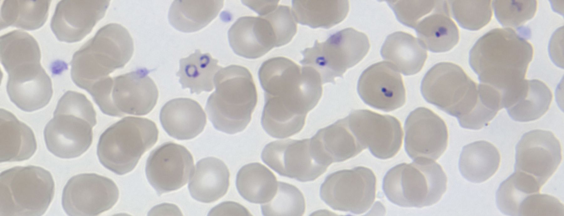 Malaria parasites can become more virulent in vaccinated hosts