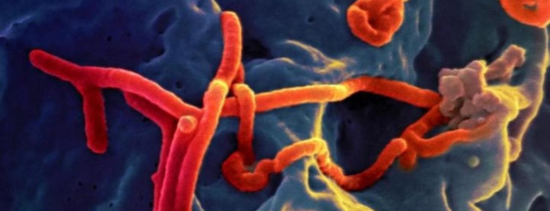 Predicting outcomes of the Ebola epidemic in Liberia