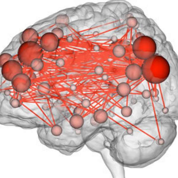 A visualization of brain regions and connections. Penn State researchers will study which connections are important for scientific creative thinking. IMAGE: PENN STATE