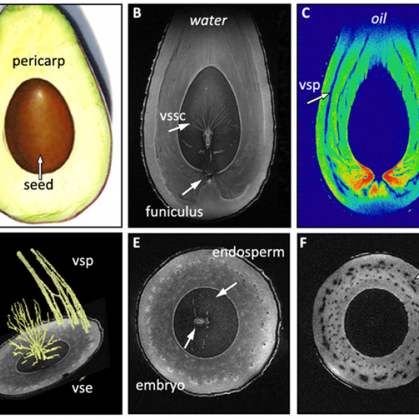 Figure: MRI of an avocado. (A) Photograph of dissected fruit showing ﬂeshy pericarp and stony seed. (B–F) Internal structure of the fruit as visualized by MRI; (B, E) distribution of water shown in longitudinal and cross-section; (C, F) distribution of lipid (given in color-code (C) or in gray scale (F)); (D) visualization of the vascular system in the seed and the fruit. Abbreviations: vse-vascular system of embryo (fragment), vsp-vascular system of pericarp (fragment), vssc-vascular system of seed coat.