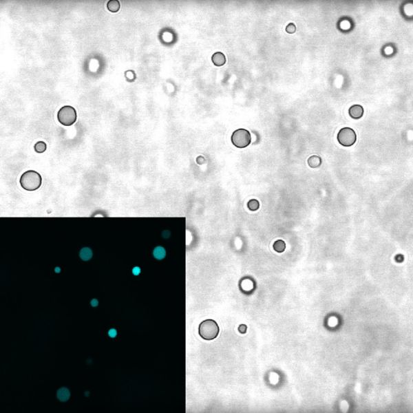 Membraneless protocells — called complex coacervates — can bring together molecules of RNA, allowing the RNAs to perform certain reactions, an important step in the origin of life on Earth. The Image shows droplets of complex coacervates as seen under a microscope. The inset shows RNA molecules (cyan) are highly concentrated inside the droplets compared to the surrounding (dark). At roughly 2-5 micrometers in diameter, the droplets are about 14-35 times thinner than human hair. IMAGE: BEVILACQUA LABORATORY, PENN STATE