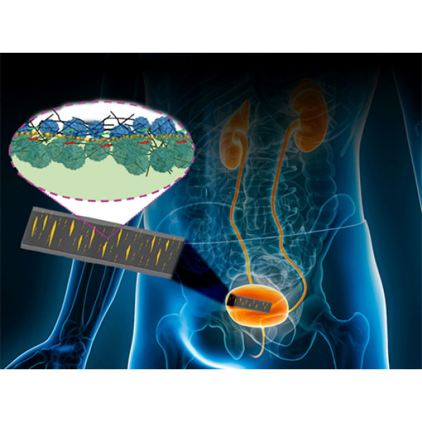 A flexible, skin-like sensor can monitor movement and electrical signals inside the body, with the potential to aid healing and bladder control. Credit: Huanyu “Larry” Cheng and Jennifer M. McCann. All Rights Reserved.