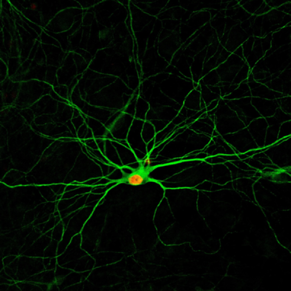 A simple treatment using four small molecules converts human astrocytes – a common type of cells in the nervous system – into new neurons, which develop complex structures after 4 months, as pictured. Credit: Gong Chen Lab, Penn State