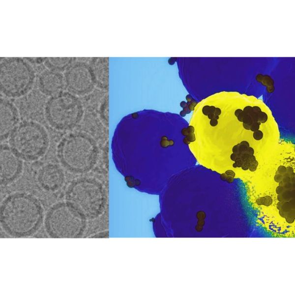 On the left is an electron microscopic image of the nanoparticles designed by the team led by Penn State researchers. On the right, the nanoparticles, shown as black dots, find the basal-like breast cancer cells in yellow and deliver the gene-editing tools. The disintegrating cell demonstrates the destructive power of the therapy delivered by the nanoparticle. Credit: Provided by Dipanjan Pan. All Rights Reserved.