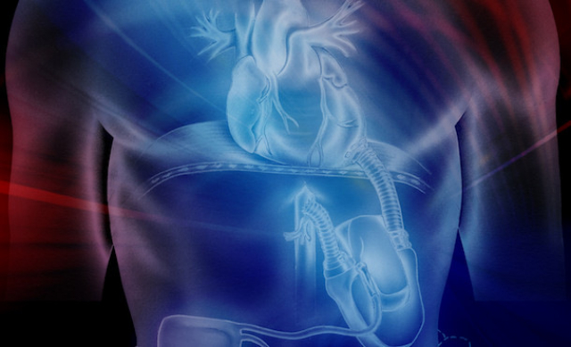 Medical devices, such as artificial hearts, are prone to blood clots. IMAGE: PENN STATE