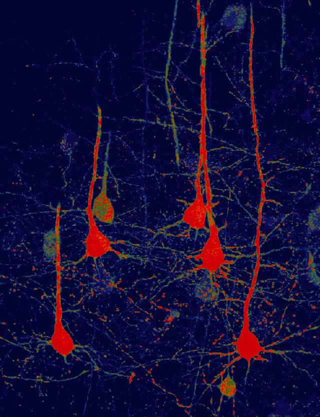 Image of neurons (red) that were converted from glial cells using a new NeuroD1-based gene therapy in a stroke-injured mouse brain. Credit: Chen Laboratory, Penn State