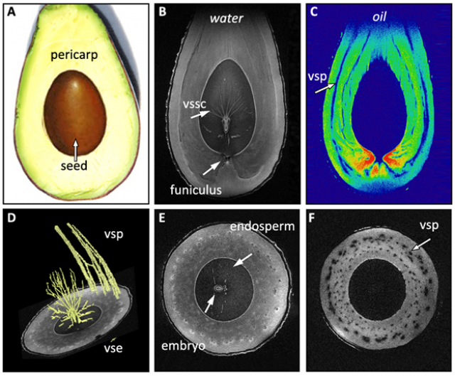 Figure: MRI of an avocado. (A) Photograph of dissected fruit showing fleshy pericarp and stony seed. (B–F) Internal structure of the fruit as visualized by MRI; (B, E) distribution of water shown in longitudinal and cross-section; (C, F) distribution of lipid (given in color-code (C) or in gray scale (F)); (D) visualization of the vascular system in the seed and the fruit. Abbreviations: vse-vascular system of embryo (fragment), vsp-vascular system of pericarp (fragment), vssc-vascular system of seed coat.