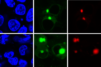 The new AggTag method allows researchers to see the previously undetectable but potentially disease-causing intermediate forms of proteins as they misfold. The method uses fluorescence to simultaneously detect two different proteins (red, green) within the cell (blue). Credit: Zhang lab, Penn State