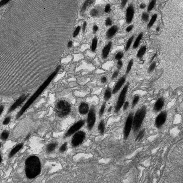 Zebrafish retina, Instrument: JEOL 1200 TEM