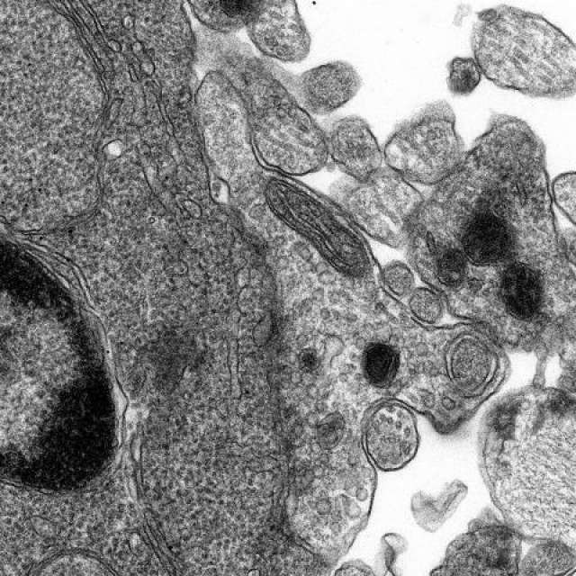 Synapse formation in a cultured cell, Instrument: JEOL 1200 TEM