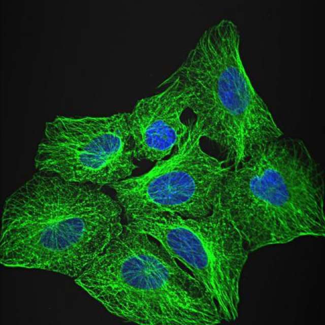 Cultured cancer cells, Instrument: Olympus FV1000 confocal